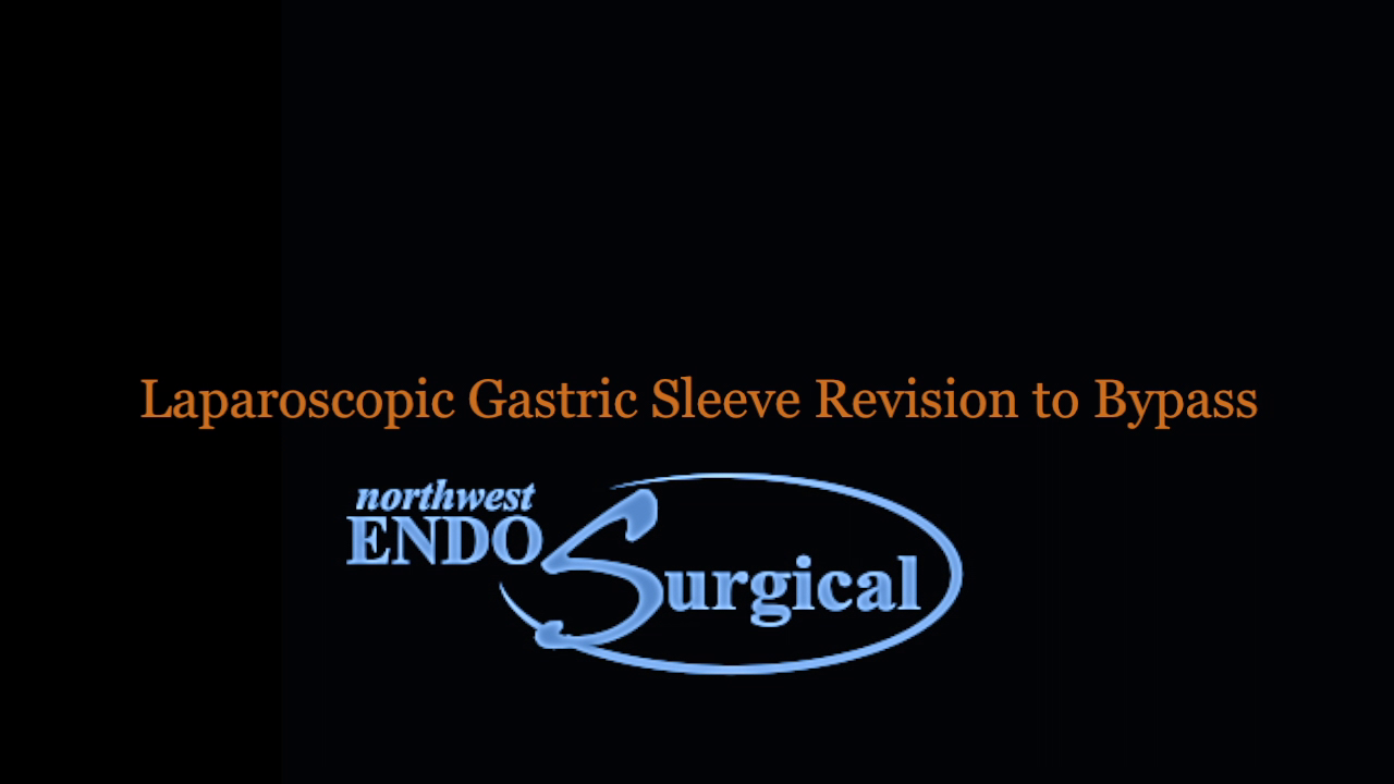 Gastric Sleeve to Bypass Revision Houston, TX Dr. Matthew St. Laurent