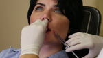 Dermal Fillers
