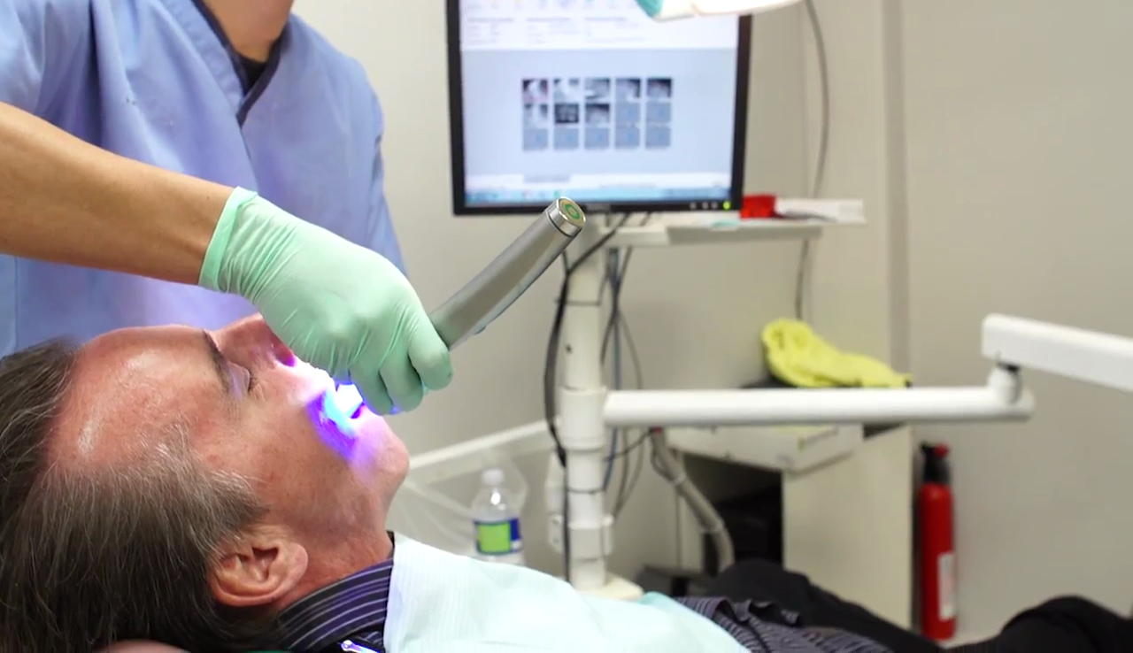 Teeth Whitening Los Algodones, Baja California, Mexico