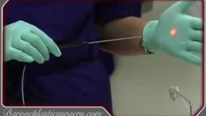 san antonio lipo c injections Liquid Lipo in San Antonio, TX in San Antonio TX