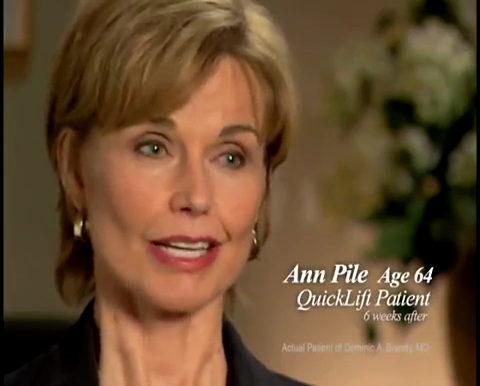 QuickLift by Dr. Barone- San Antonio/ Austin Area Board Certified ...