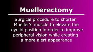 Muellerectomy (Eyelid Tightening Surgery)