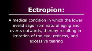 Watch an Ectropion Surgery