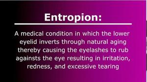 Watch an Entropion Surgery