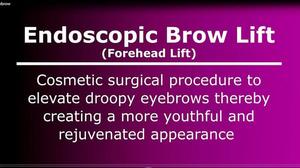 Watch an Endoscopic Brow Lift Surgery