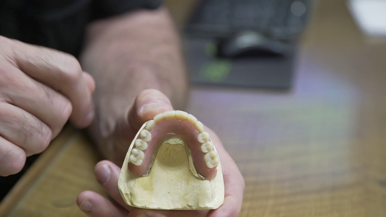 Overdentures Billings, MT Boise, ID Dr. David Casagrande