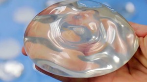 Implant Safety Improvements