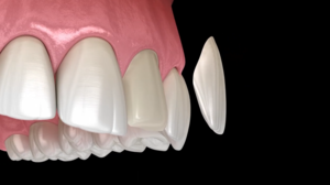 Conceal Cosmetic Concerns