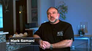 The Advantages of All-on-4 Dental Implants