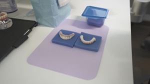 Taking Dentures to the Next Level with All-on-X