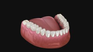 Invisalign Is a Convenient Option for Teens and Adults