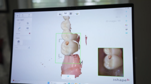 Southern Dental Implant Technology