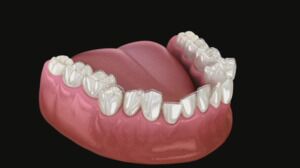 Straighten Your Teeth With Invisalign