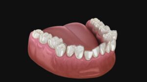 A Modern Ortho Solution