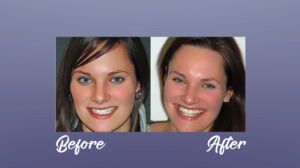 What Patients Can Expect V2