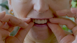 A Step Up from Traditional Dentures