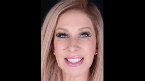 Stephanie's Zirconia Crown Smile Makeover: Getting Her Confidence Back
